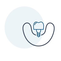 implantologia implantologia